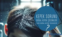 Kepek İçin Doğal Çözümler ve Evde Doğal Kepek Tedavileri