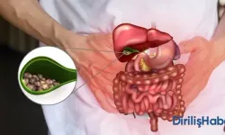 Kapalı Safra Kesesi Ameliyatı Kaç Günde İyileşir?