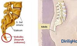 Kuyruk Sokumu Yarası Nasıl İyileşir?