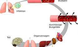 Sepsis İyileşir mi?