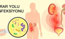 Kadınlarda İdrar Yolu Enfeksiyonuna Ne İyi Gelir?