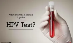 Erkeklerde HPV Testi Nasıl Yapılır?