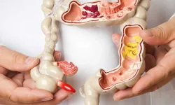 Crohn Hastalığı Nedir? belirtileri nelerdir?