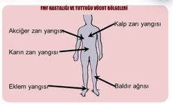 FMF hastalığı nasıl bir hastalıktır nasıl geçer❓