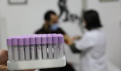 SMA Testi Nasıl Yapılır?