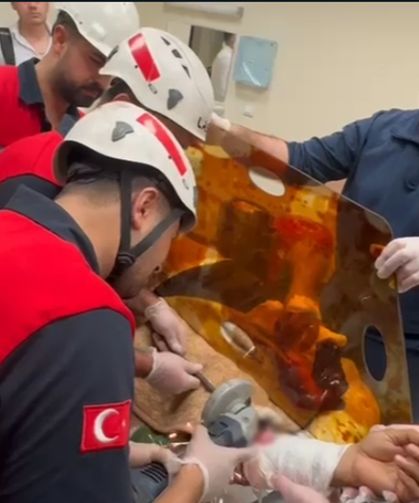 Şanlıurfa’da işçinin koluna demir şiş saplandı