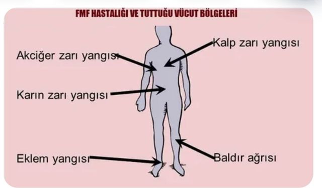 FMF hastalığı nasıl bir hastalıktır nasıl geçer❓