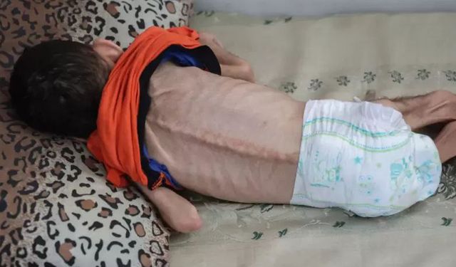 BM: Gazze’de açlık, hastalık ve toplu ölümler kapıda