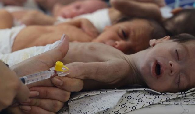 BM: Gazze'de bebeklerin yüzde 92'si açlık tehlikesi altında