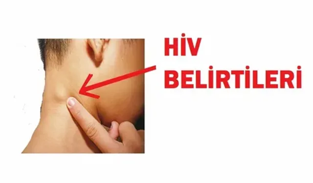 HIV Tedavisi İle tamamen kurtulmak mümkün mü?