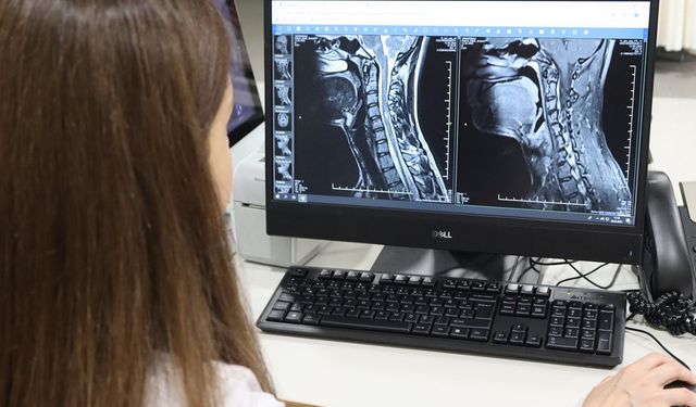 Uzmanından uyarı: Multiple Skleroz her hastada farklı seyrediyor