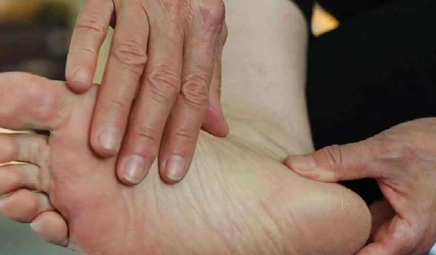 Diyabetlilere ayak yaraları için tavsiyeler